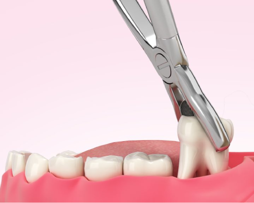 Emergency Dental Care